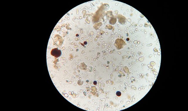 soil microbes, microscope, soil sample, soil microbes, soil microbes, soil microbes, microscope, microscope, microscope, microscope, microscope, soil sample
