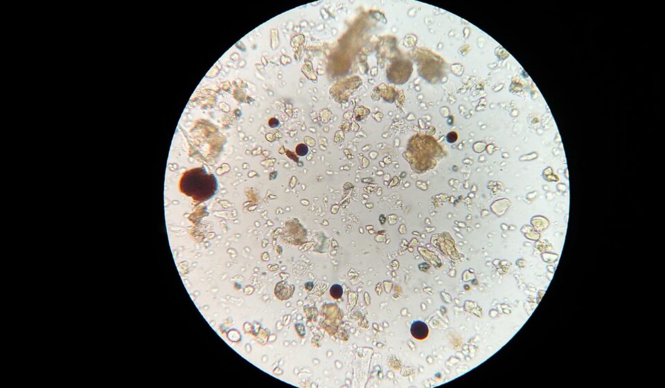 soil microbes, microscope, soil sample, soil microbes, soil microbes, soil microbes, microscope, microscope, microscope, microscope, microscope, soil sample