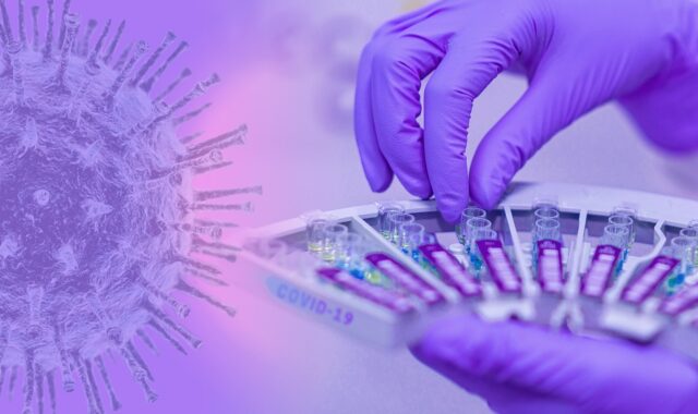 covid-19, coronavirus, epidemic, infection, exam, laboratory, medical, pathogen, corona-virus, laboratory, laboratory, laboratory, laboratory, laboratory