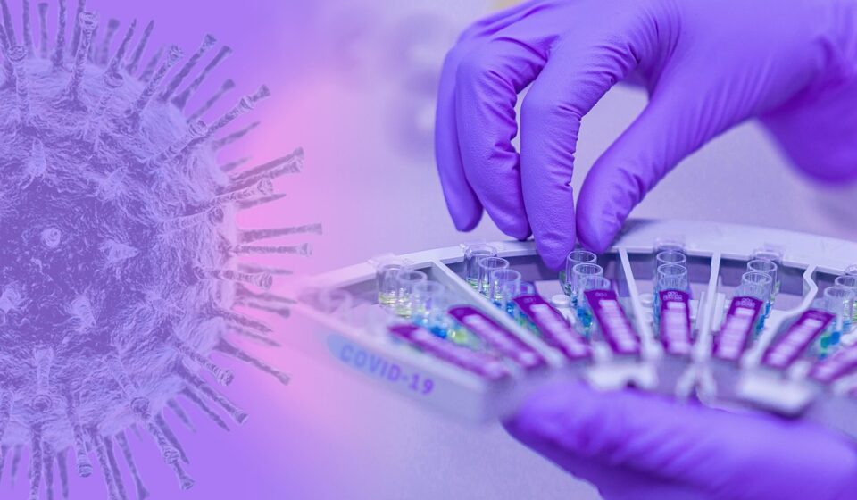 covid-19, coronavirus, epidemic, infection, exam, laboratory, medical, pathogen, corona-virus, laboratory, laboratory, laboratory, laboratory, laboratory