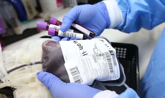 donation, donate, plasma, donor, life, biology, transfusion, give, health, medical, blue health, blue medical, blue life, blue blood