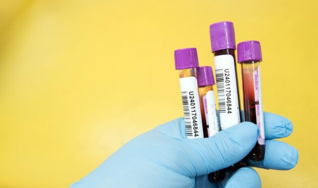 sample, lab, laboratory, scientist, test, medical, healthcare, health, research, science, tube, yellow health, yellow medical, yellow science, yellow research, yellow lab, yellow test, yellow blood, yellow laboratory, yellow healthcare