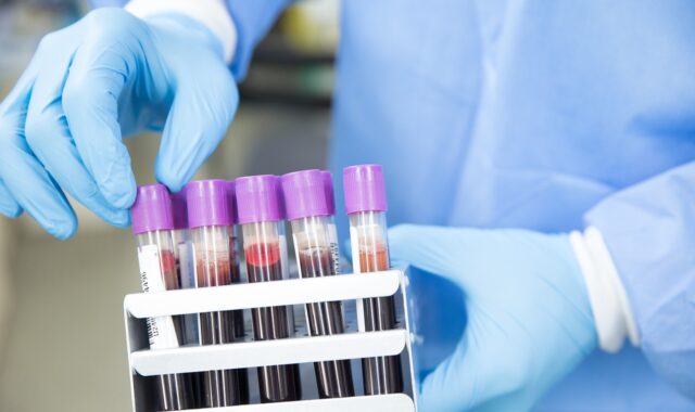 sample, lab, laboratory, scientist, medical, health, test, science, healthcare, research, tube, blue health, blue medical, blue science, blue research, blue lab, blue test, blue blood, blue laboratory, blue healthcare