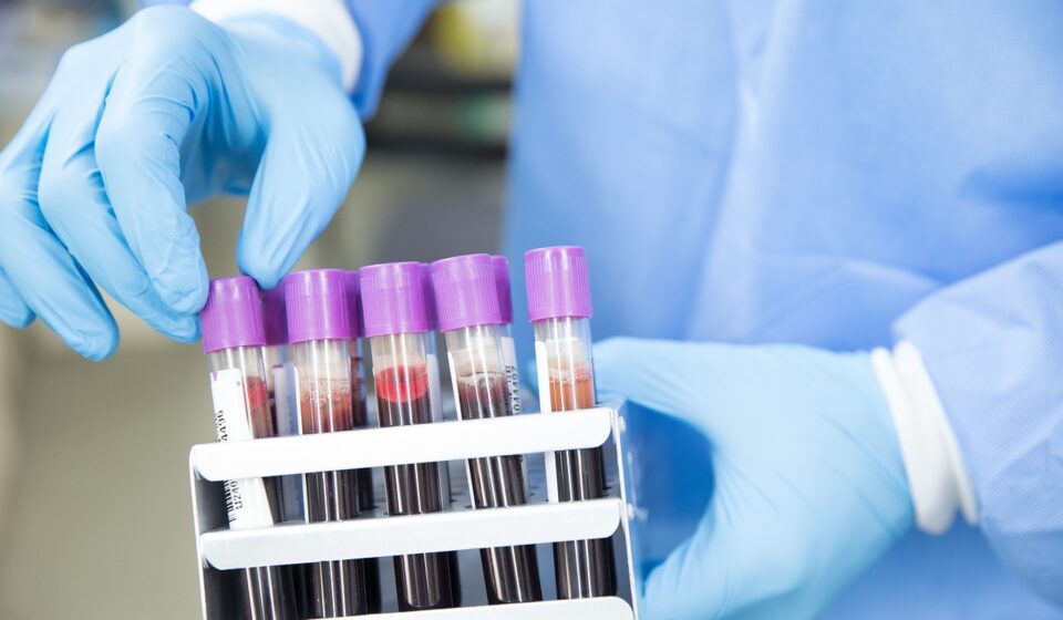 sample, lab, laboratory, scientist, medical, health, test, science, healthcare, research, tube, blue health, blue medical, blue science, blue research, blue lab, blue test, blue blood, blue laboratory, blue healthcare