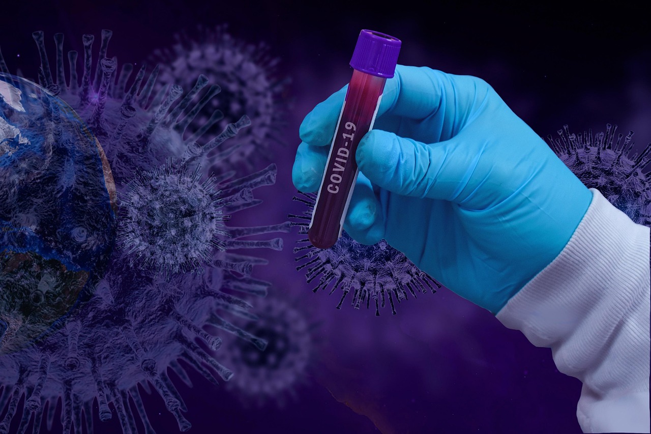 covid-19, coronavirus, epidemic, infection, exam, laboratory, medical, pathogen, corona-virus, covid-19, covid-19, covid-19, coronavirus, coronavirus, coronavirus, coronavirus, coronavirus