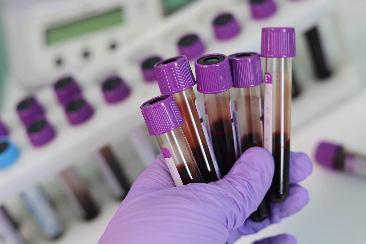 laboratory, medical, medicine, hand, research, lab, test, doctor, equipment, scientist, woman, chemistry, science, hospital, experiment, person, technician, technology, healthcare, working, health, tube, work, research lab, blood samples, blood samples, blood samples, blood samples, blood samples, blood samples