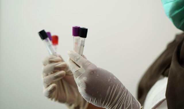 laboratory, test tubes, medical staff, researcher, coronavirus, pandemic, lab test, blood sample, blood specimen, test tubes, medical staff, medical staff, medical staff, medical staff, medical staff, lab test, blood sample, blood sample, blood sample, blood sample, blood sample